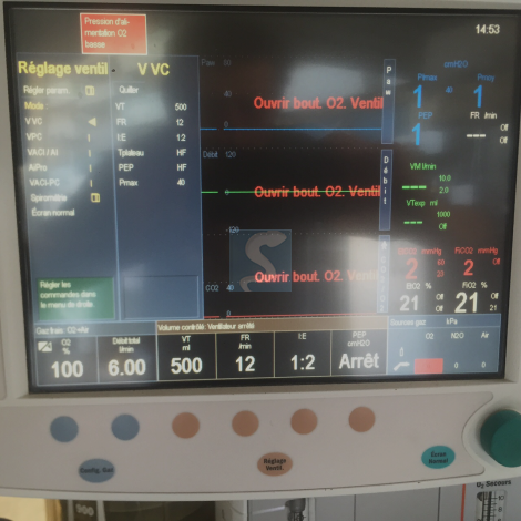 Respirateur d'anesthesie GE Datex-Ohmeda S/5 Avance  