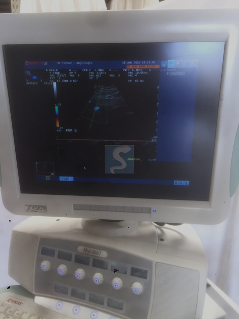 Echographe Esaote MyLab60