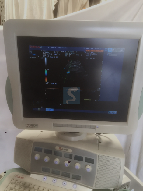 Echographe Esaote MyLab60