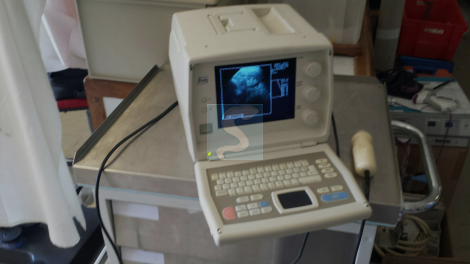 Echographe Kretz Combison 301 