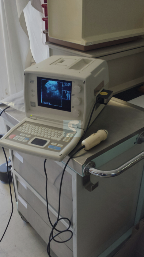 Echographe Kretz Combison 301 