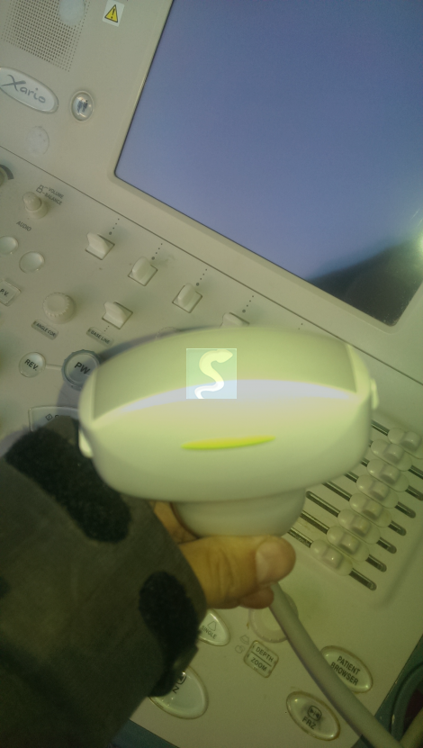 Echographe Toshiba Xario