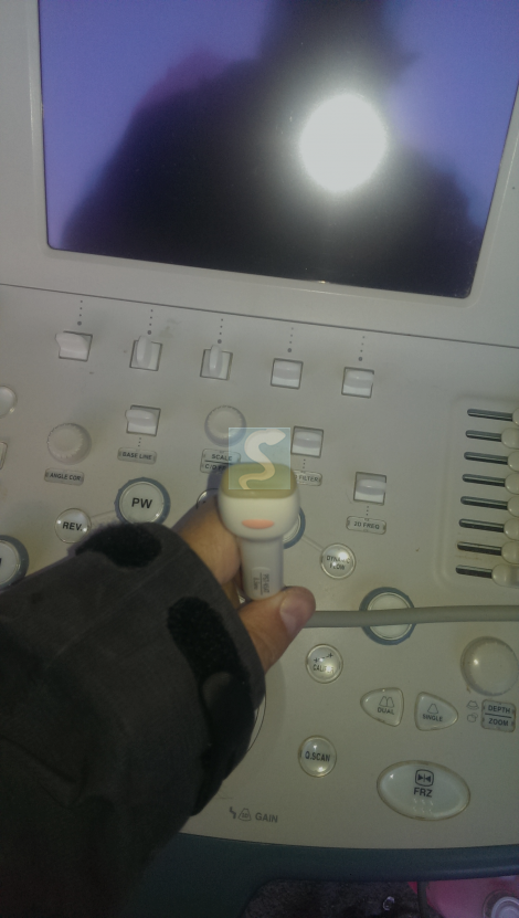 Echographe Toshiba Xario