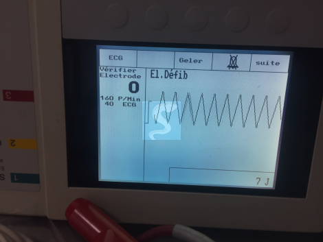 Défibrillateur HELLIGE Cardioserv