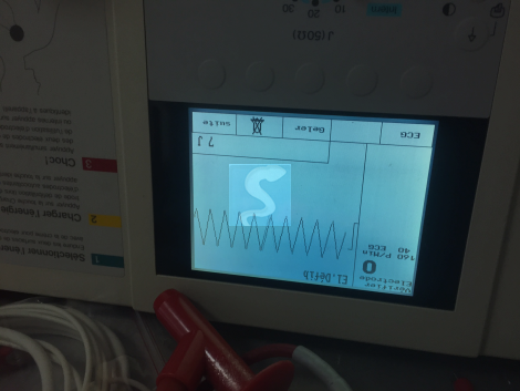 Défibrillateur HELLIGE Cardioserv
