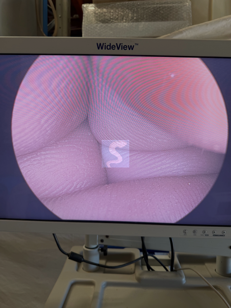 COLONNE Video STORZ Image 1 Pure HD